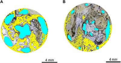 Cortico-cancellous osseointegration into additively manufactured titanium implants using a load-bearing femoral ovine model